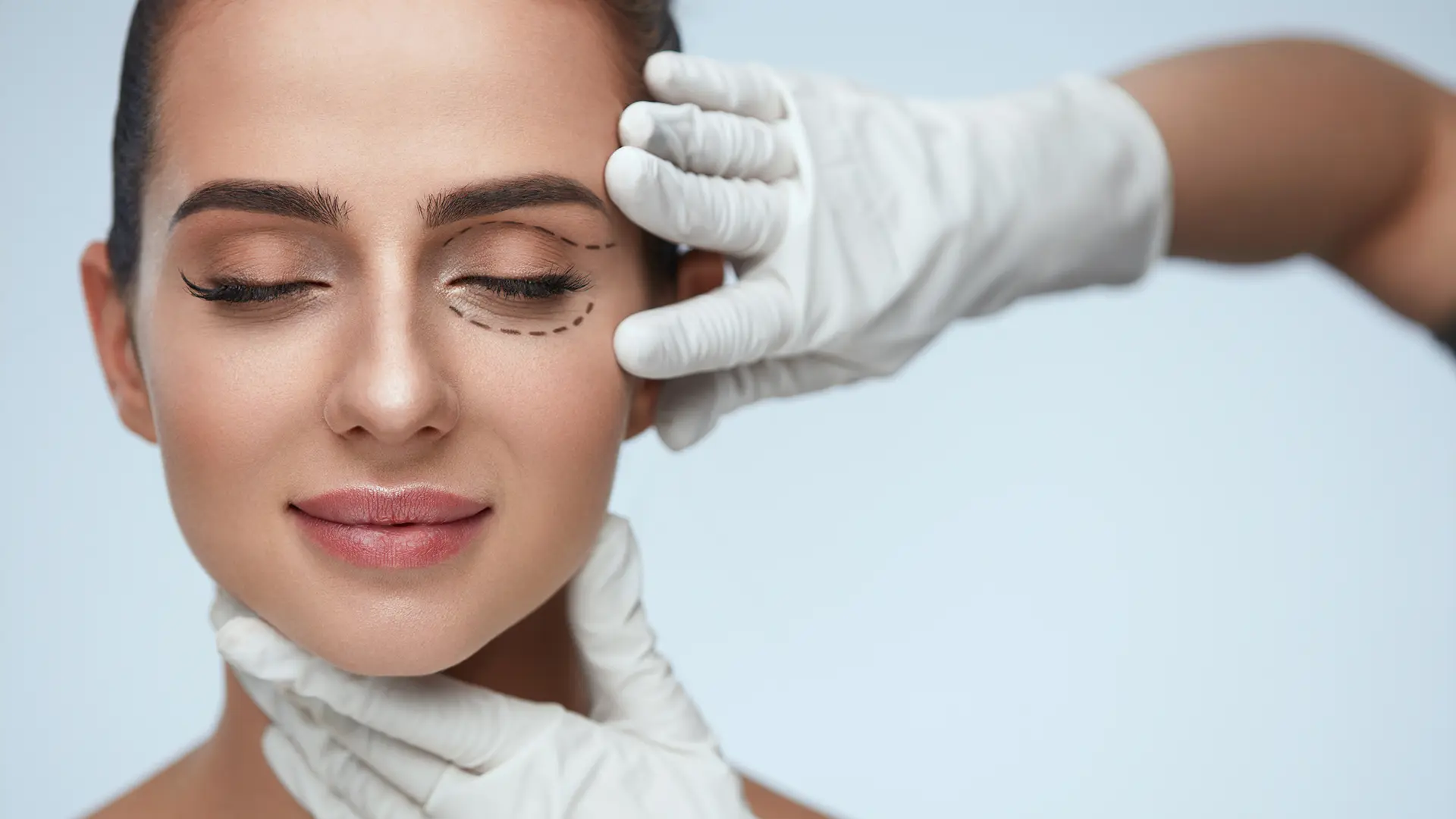 tratamento-blefaroplastia-inferior